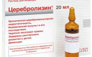 Церебролизин — инструкция и цена