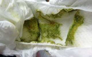 Почему у малышей при ГВ бывает зеленый стул?