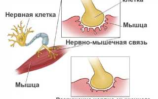 Миастения