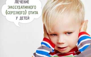 Двусторонний экссудативный отит у детей лечение