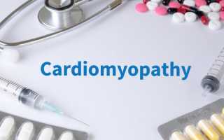 Кардиомиопатия