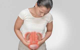 Уротелиальная карцинома — подробно о болезни