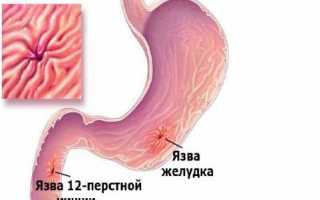 Как пить Омепразол правильно?