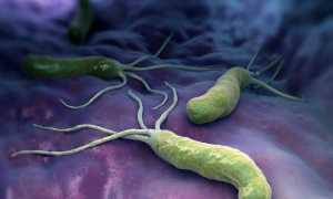 Как Прополисом лечить хеликобактер пилори?