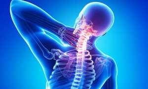 Как использовать Дексаметазон при остеохондрозе?