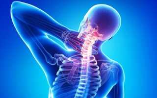 Как использовать Дексаметазон при остеохондрозе?