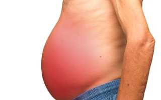 Все о асците