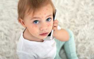 Диазолин — инструкция и цена