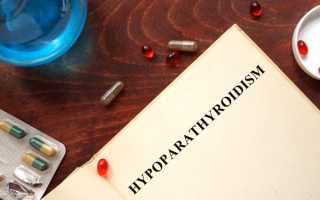 Гипопаратиреоз