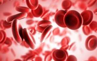 Гемолитическая анемия