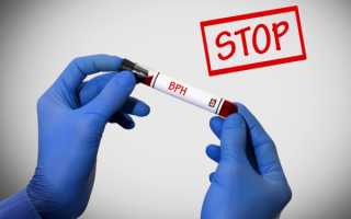 Аденома простаты: лечение народными средствами