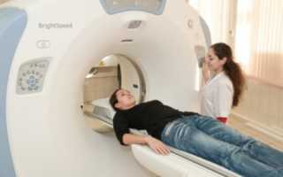 Что нужно знать о КТ легких?