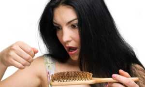 Подробно об андрогенной алопеции у женщин