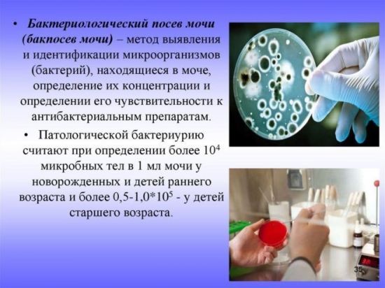 Бакпосев