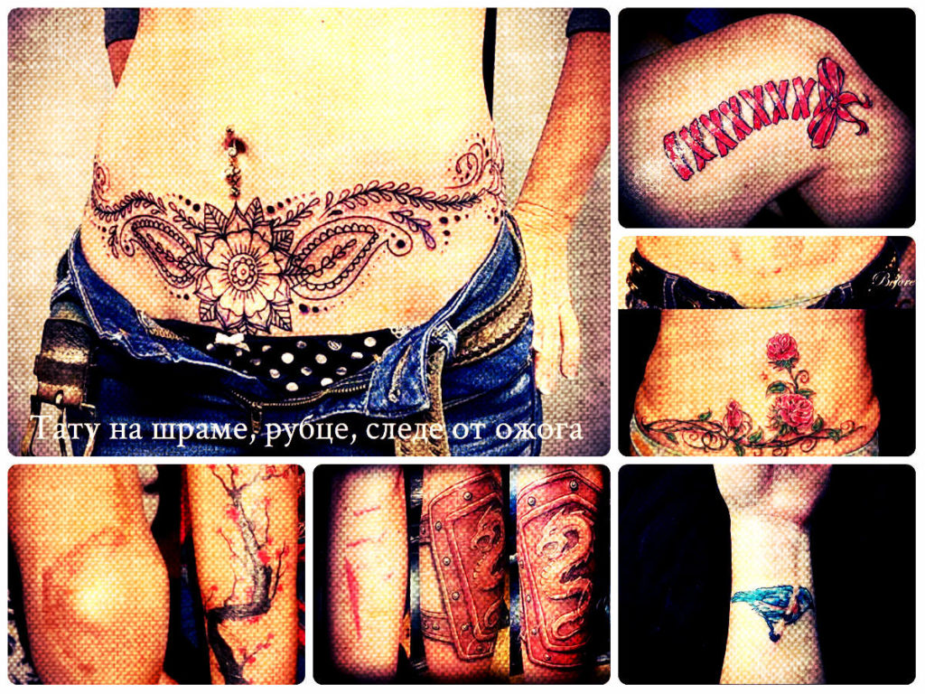 Тату на шраме, рубце, следе от ожога - фото примеры готовых татуировок
