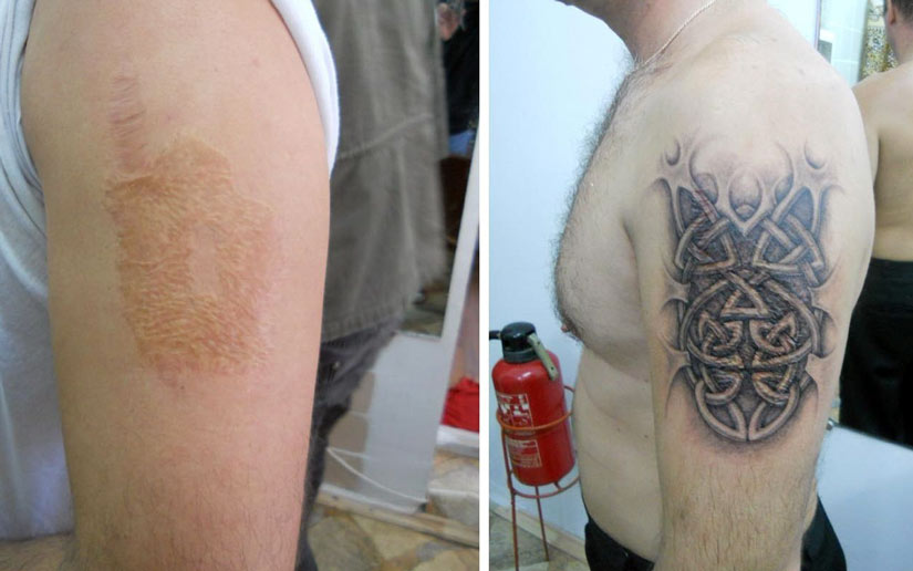 Мужская татуировка тату на шраме скрывающие шрам Мужская татуировка тату на шраме скрывающие шрам