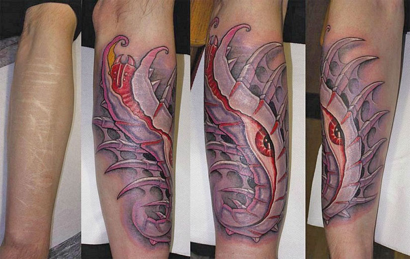 Перекрытие шрама татуировкой Перекрытие шрама татуировкой