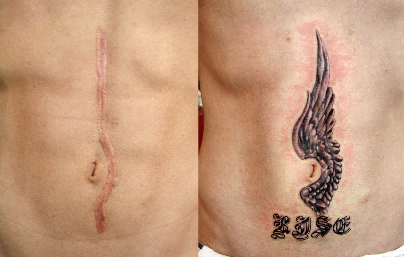 Тату на месте шрама Тату на месте шрама