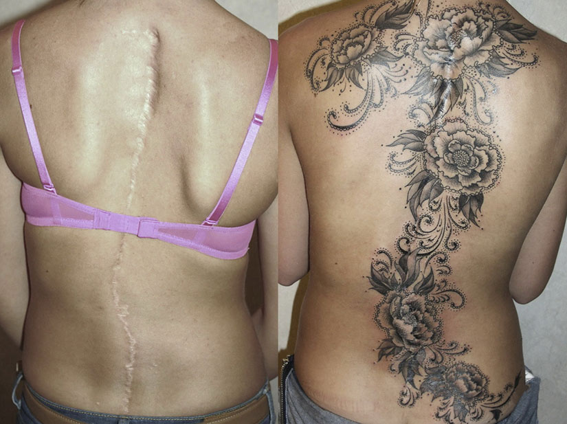 Тату на шрамах на спине Тату на шрамах на спине