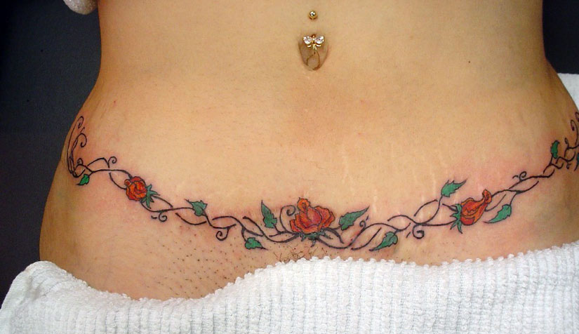 Цветочная тату вместо шрама Цветочная тату вместо шрама